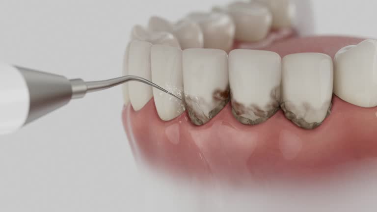 Reliable Dental Implants contractor in Bellflower, CA by Smile Center Dentistry